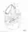 Fig. 03 - INFLATABLE TRANSLUMENAL SHUNTS AND METHODS AND DEVICES FOR DELIVERY