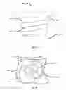 Fig. 08 - INFLATABLE TRANSLUMENAL SHUNTS AND METHODS AND DEVICES FOR DELIVERY