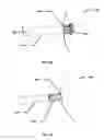 Fig. 14 - INFLATABLE TRANSLUMENAL SHUNTS AND METHODS AND DEVICES FOR DELIVERY