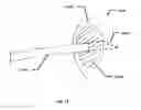 Fig. 15 - INFLATABLE TRANSLUMENAL SHUNTS AND METHODS AND DEVICES FOR DELIVERY