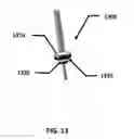Fig. 17 - INFLATABLE TRANSLUMENAL SHUNTS AND METHODS AND DEVICES FOR DELIVERY