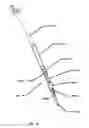 Fig. 24 - INFLATABLE TRANSLUMENAL SHUNTS AND METHODS AND DEVICES FOR DELIVERY
