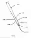 Fig. 25 - INFLATABLE TRANSLUMENAL SHUNTS AND METHODS AND DEVICES FOR DELIVERY