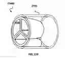 Fig. 33 - INFLATABLE TRANSLUMENAL SHUNTS AND METHODS AND DEVICES FOR DELIVERY