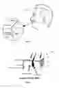 Fig. 02 - Dermatology Treatment Device