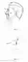 Fig. 04 - Dermatology Treatment Device