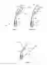 Fig. 06 - Dermatology Treatment Device