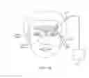 Fig. 13 - Systems and methods for delivery of a therapeutic agent