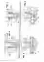 Fig. 04 - Anti-reflux catheter