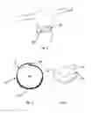 Fig. 02 - Lower back electrical stimulator