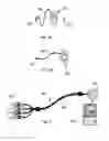Fig. 05 - Lower back electrical stimulator