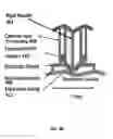 Fig. 06 - Expandable catheter devices electrode array
