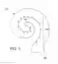 Fig. 04 - COCHLEAR IMPLANT HEARING ASSISTANCE SYSTEM AND METHOD OF FITTING THE SAME