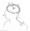 Fig. 01 - METHODS TO CONCURRENTLY STIMULATE DIFFERENT BRAIN TARGETS