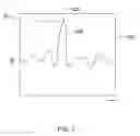 Fig. 08 - Arrhythmia detection and confirmation