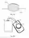 Fig. 05 - Muscle optimization device and method
