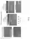 Fig. 11 - BOILING HISTOTRIPSY METHODS AND SYSTEMS FOR UNIFORM VOLUMETRIC ABLATION OF AN OBJECT BY HIGH-INTENSITY FOCUSED ULTRASOUND WAVES WITH SHOCKS