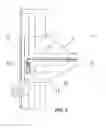 Fig. 03 - Putter
