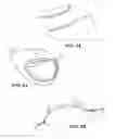 Fig. 20 - GOLF CLUB WITH MULTI-COMPONENT CONSTRUCTION