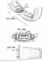 Fig. 30 - Wearable device assembly having athletic functionality