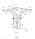 Fig. 02 - Skateboard truck with adjustable pivot point
