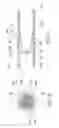Fig. 05 - Filter coupling