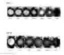 Fig. 08 - Selective surface impregnation method for catalytically active materials on particulate catalyst support using mutual repulsive force and solubility difference between hydrophilic solvent and hydrophobic solvent