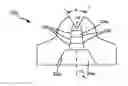 Fig. 01 - Spray tip and method of manufacture