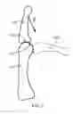 Fig. 02 - Anatomical robot