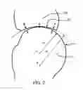 Fig. 03 - Anatomical robot