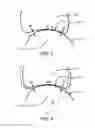 Fig. 04 - Anatomical robot