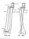 Fig. 11 - Anatomical robot
