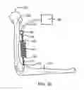Fig. 12 - Anatomical robot