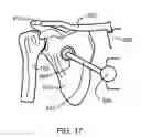 Fig. 13 - Anatomical robot