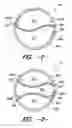 Fig. 02 - Fabric and die design for divided conduit