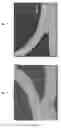 Fig. 07 - Method of manufacturing a composite part