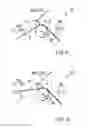 Fig. 06 - Removing unit and removing method