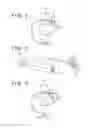 Fig. 02 - Roll-up apparatus