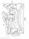 Fig. 06 - Force distributing apparatus having a threaded opening for a bicycle wheel spoke