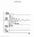 Fig. 07 - System and method for controlling impact reduction of electric vehicle