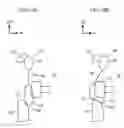 Fig. 11 - Automobile occupant protection device