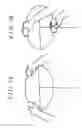 Fig. 04 - Steering system