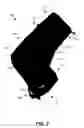 Fig. 03 - PROTECTIVE HAND COVERING