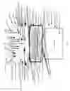 Fig. 05 - Cryogenic hydrogen radiation shield for human spaceflight
