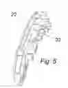 Fig. 06 - Bucket handle