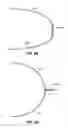 Fig. 12 - Ionomer-membrane water processing apparatus