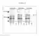 Fig. 13 - Enhanced production of recombinant CRM197 in 