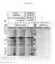 Fig. 16 - Enhanced production of recombinant CRM197 in 
