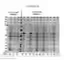 Fig. 25 - Enhanced production of recombinant CRM197 in 