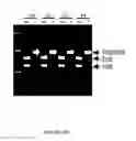 Fig. 07 - Ribosomes with tethered subunits